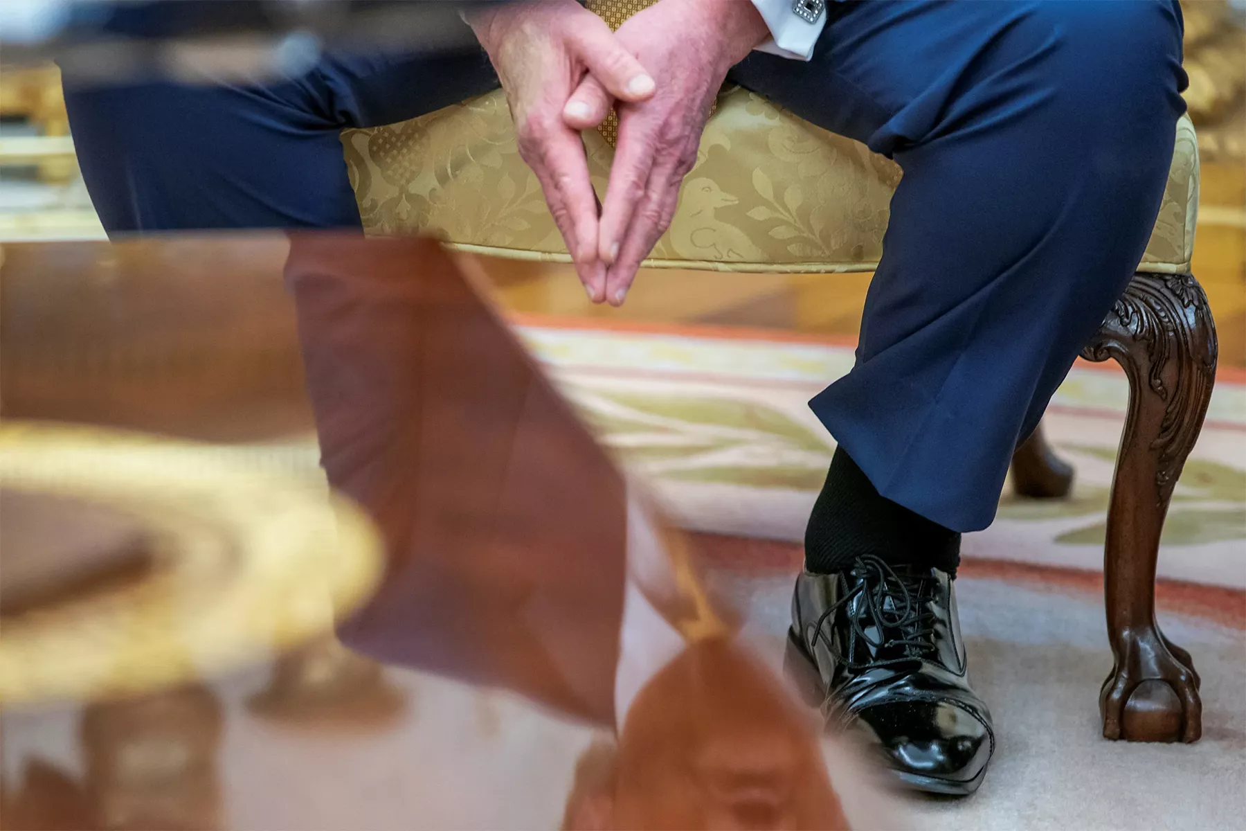 President Trump’s chronic venous insufficiency (CVI) diagnosis explained: symptoms, causes, and modern treatments for this common, treatable vein disease.