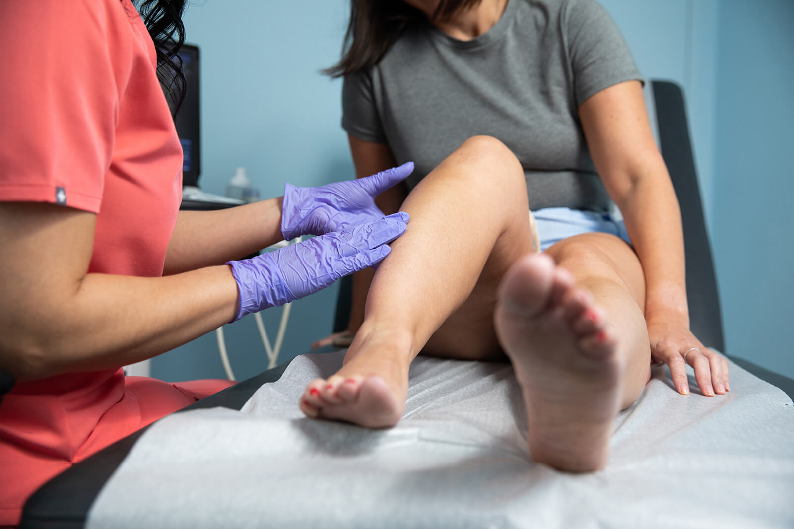 Una pierna de una persona con venas varicosas visibles, tobillos hinchados y piel decolorada, ilustrando s&iacute;ntomas comunes de la insuficiencia venosa cr&oacute;nica