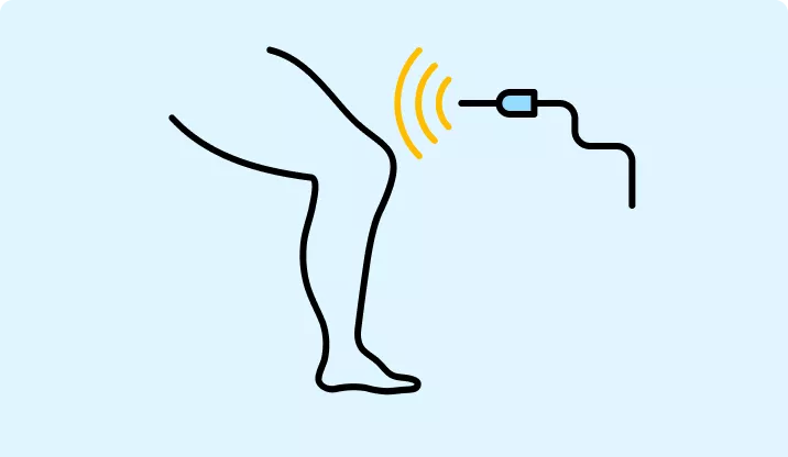 Endovenous Laser Ablation